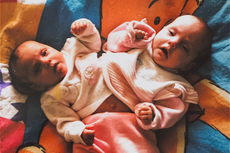 ‘People called us freak babies’: Former conjoined twin finds new life as influencer