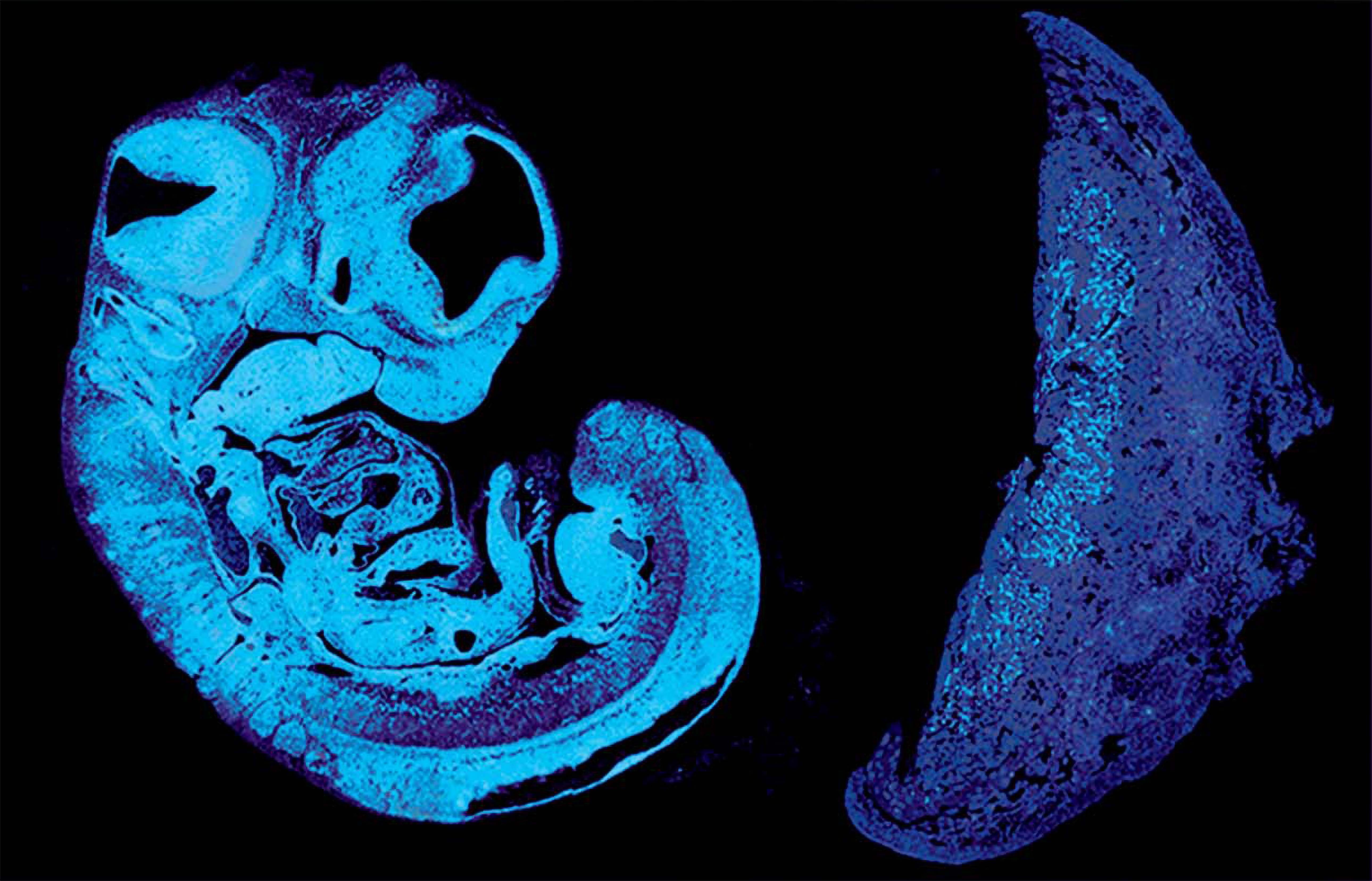 Cambridge scientists have identified a key signal that the baby uses to control its supply of nutrients from the placenta (Ionel Sandovici/PA)