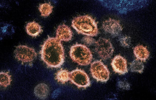 <p>Electron microscope image of novel coronavirus </p>