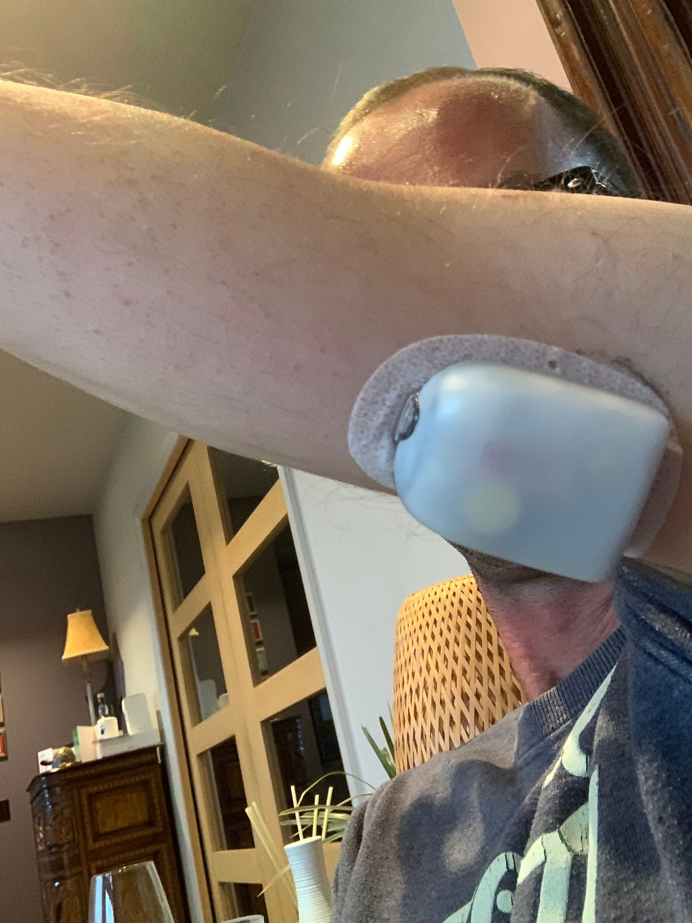 Paul McNairney wearing the Omnipod (Digby Brown/PA)