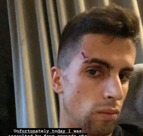 Manchester City’s Joao Cancelo revealed his injuries on Instagram