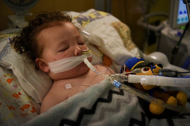 <p>Adrian James, then 2 years old, breathed with the help of a ventilator at SSM Health Cardinal Glennon Children’s Hospital on 5 October, 2021</p>