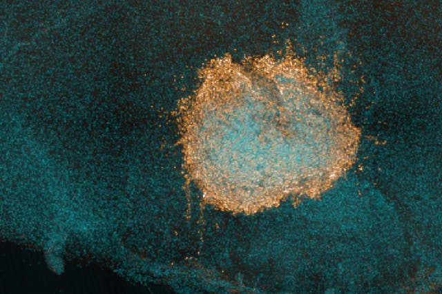 T cells, generated both by vaccinations and COVID-19 infections, have been shown to be critical in limiting progression to severe disease by eliminating virus-infected cells and helping with other immune system functions.