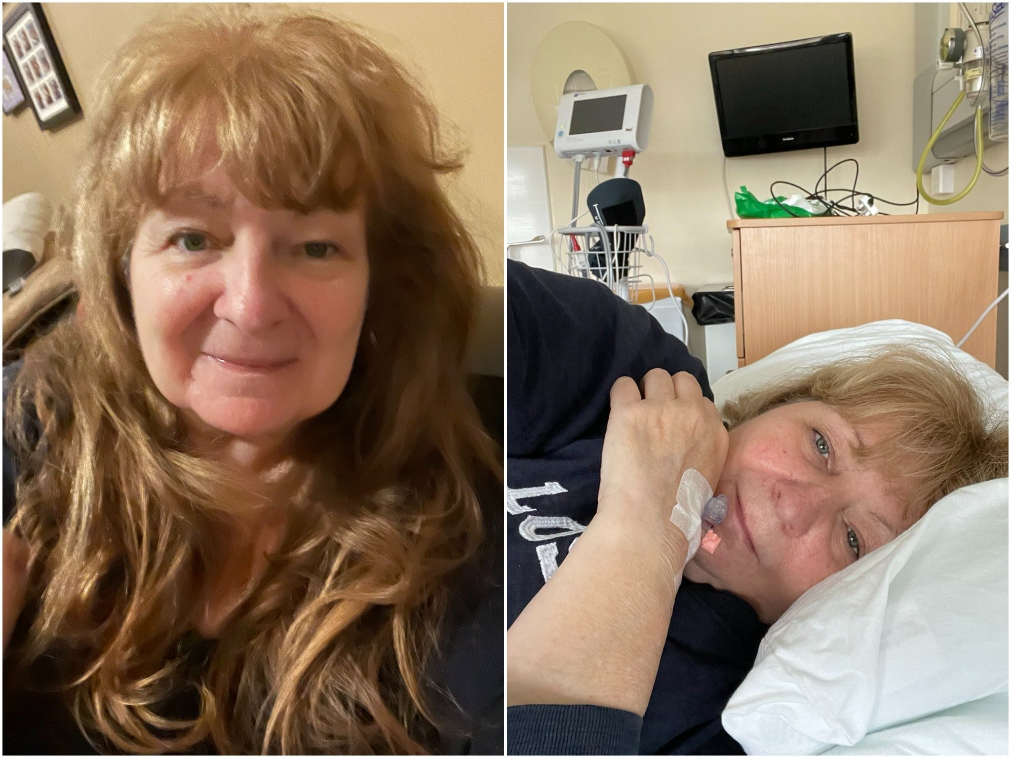 Godley the night before her operation (left) and at her initial diagnosis