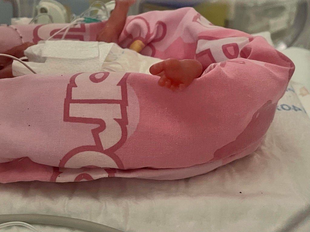Parents of UK’s smallest premature baby born weighing just 325g finally able to hold her