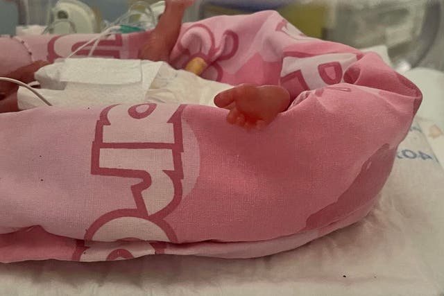 <p>Hannah now weighs 547g and will go home when strong enough </p>