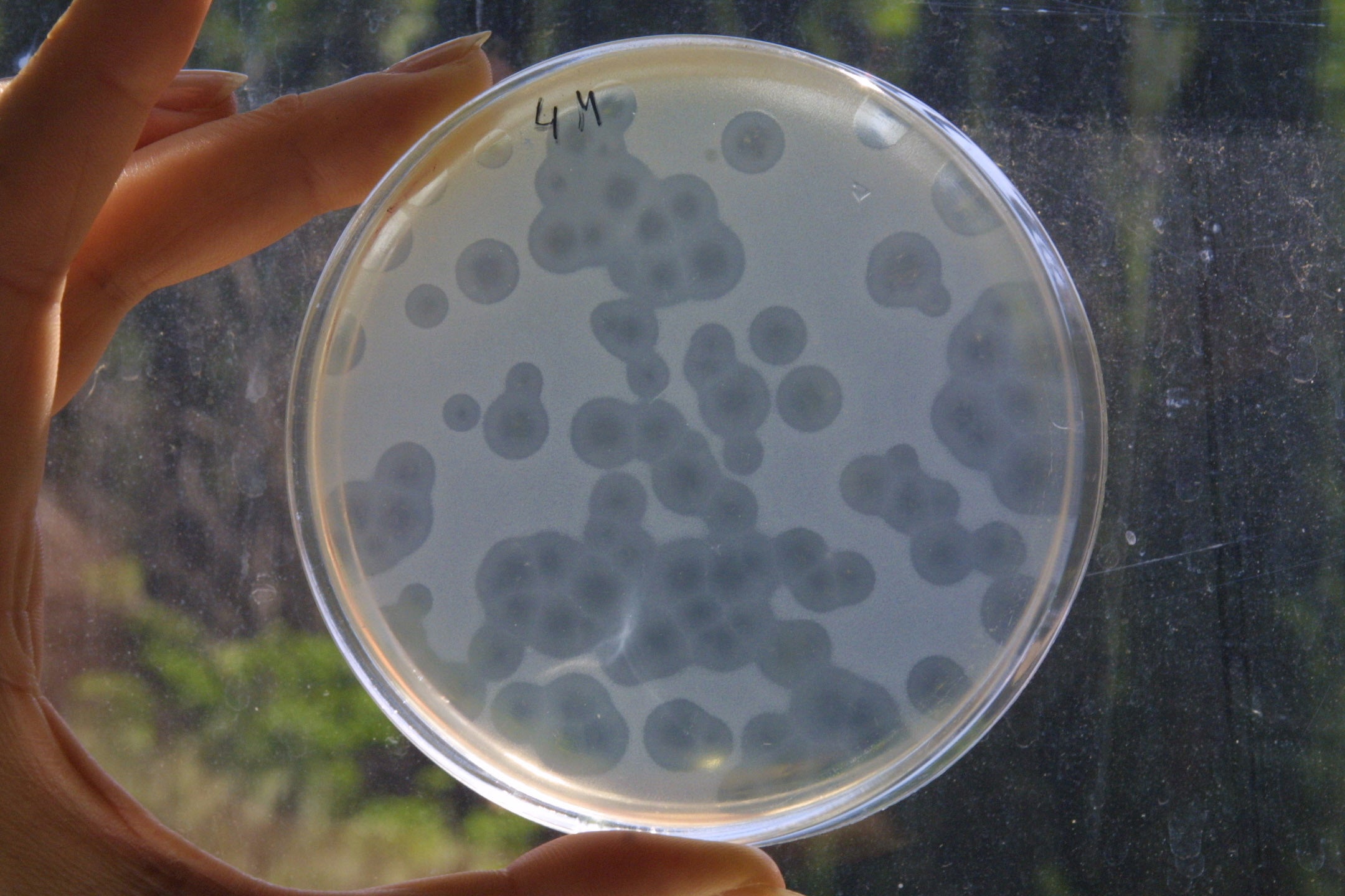 A doctor holds a bacterium sample at the laboratory of the Eliava Institute in Tbilissi