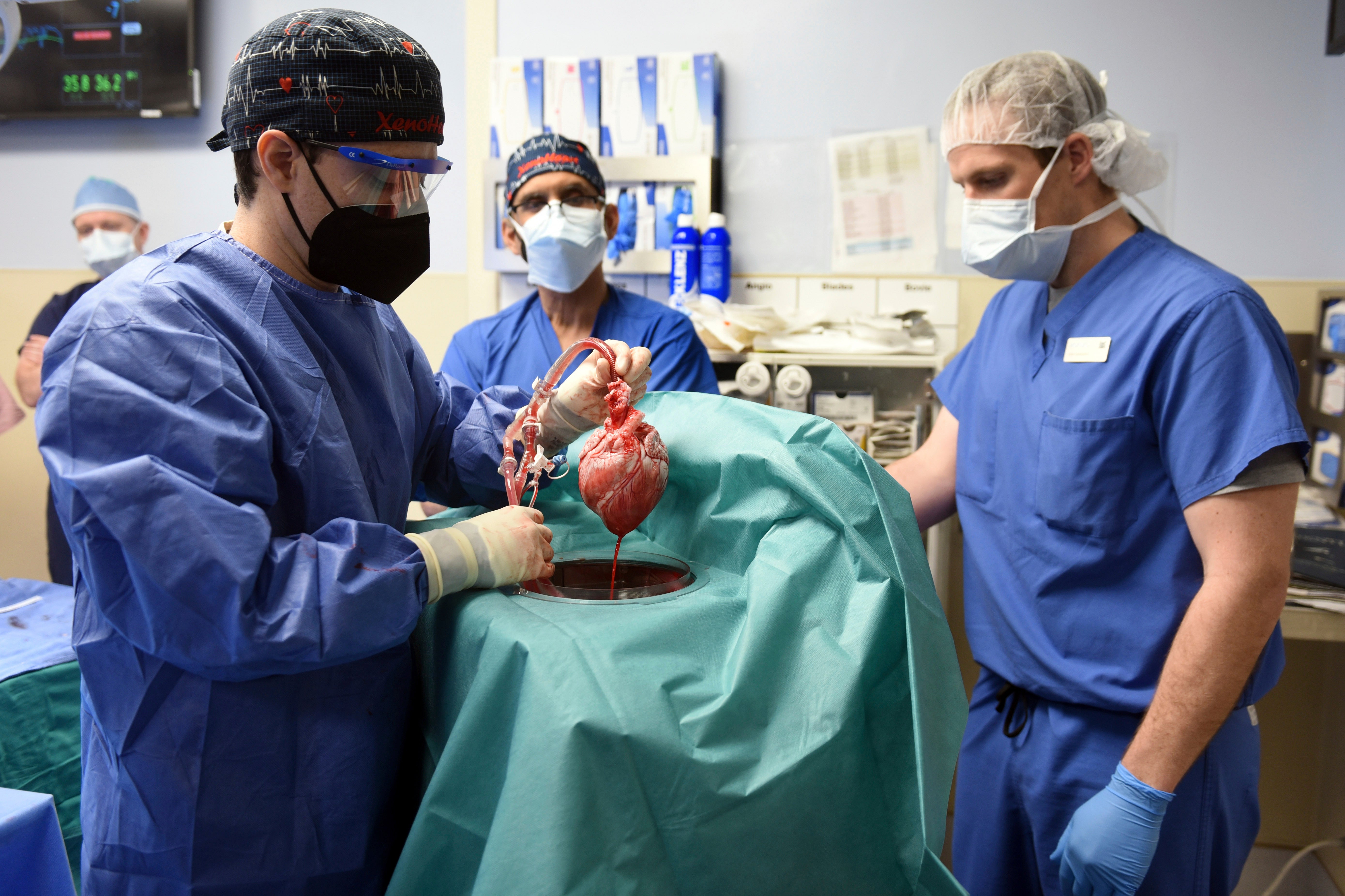World first: doctors hold up the pig heart transplanted into Bennett earlier this month