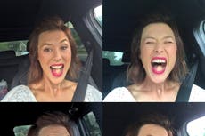 Women has tongue replaced with part of her leg following cancer