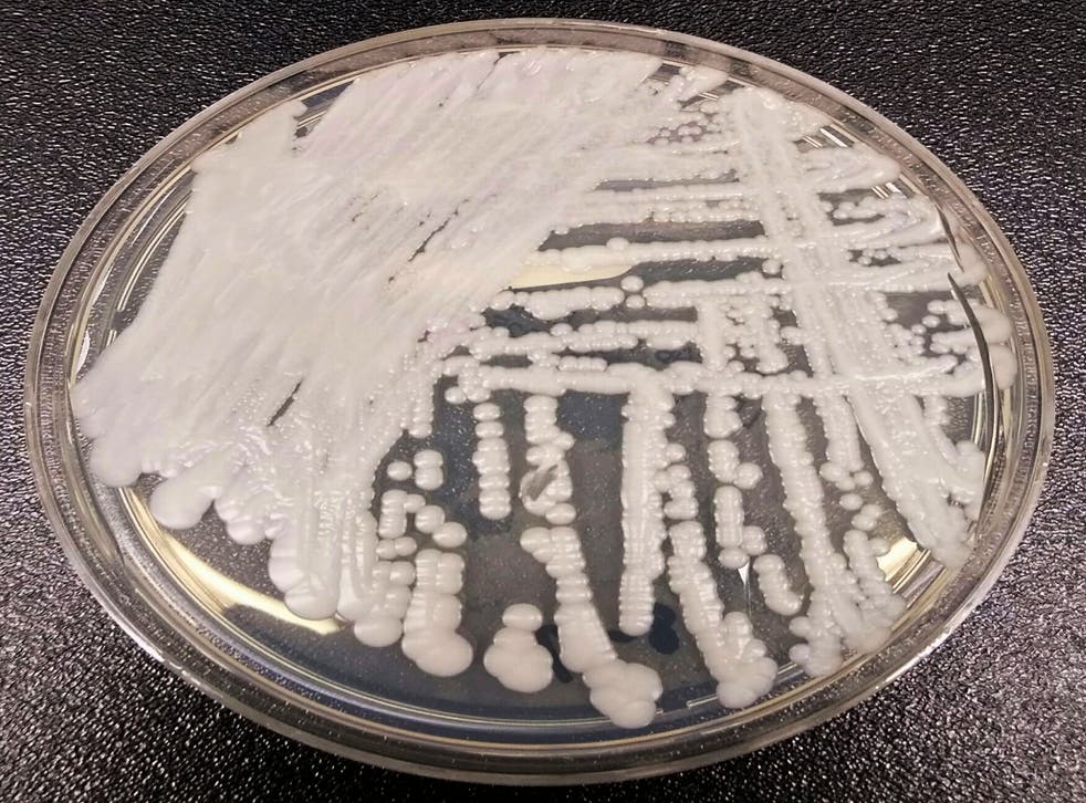 Superbug Fungus-Louisiana