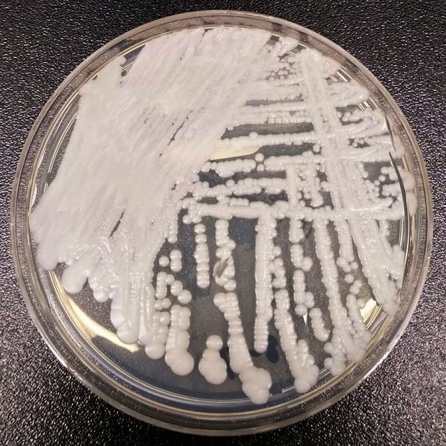 <p>File photo: This undated photo made available by the CDC shows a strain of ‘Candida auris’ </p>