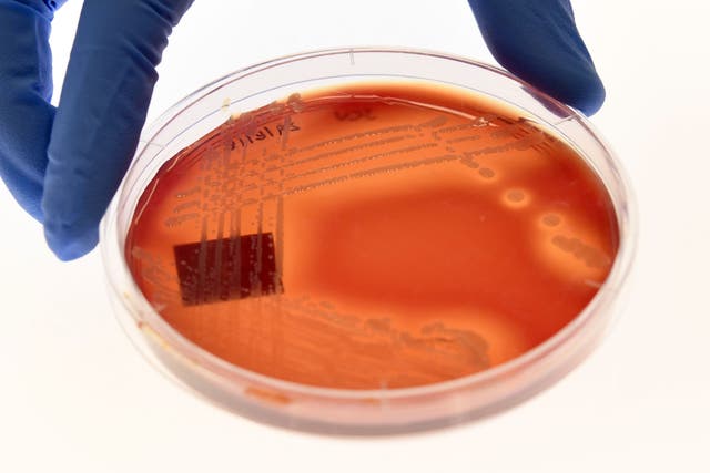 <p>Jean Lee, a PhD student at Melbourne’s Doherty Institute, displays the superbug ‘Staphylcocus epidermidis’ on an agar plate in Melbourne on 4 September 2018</p>