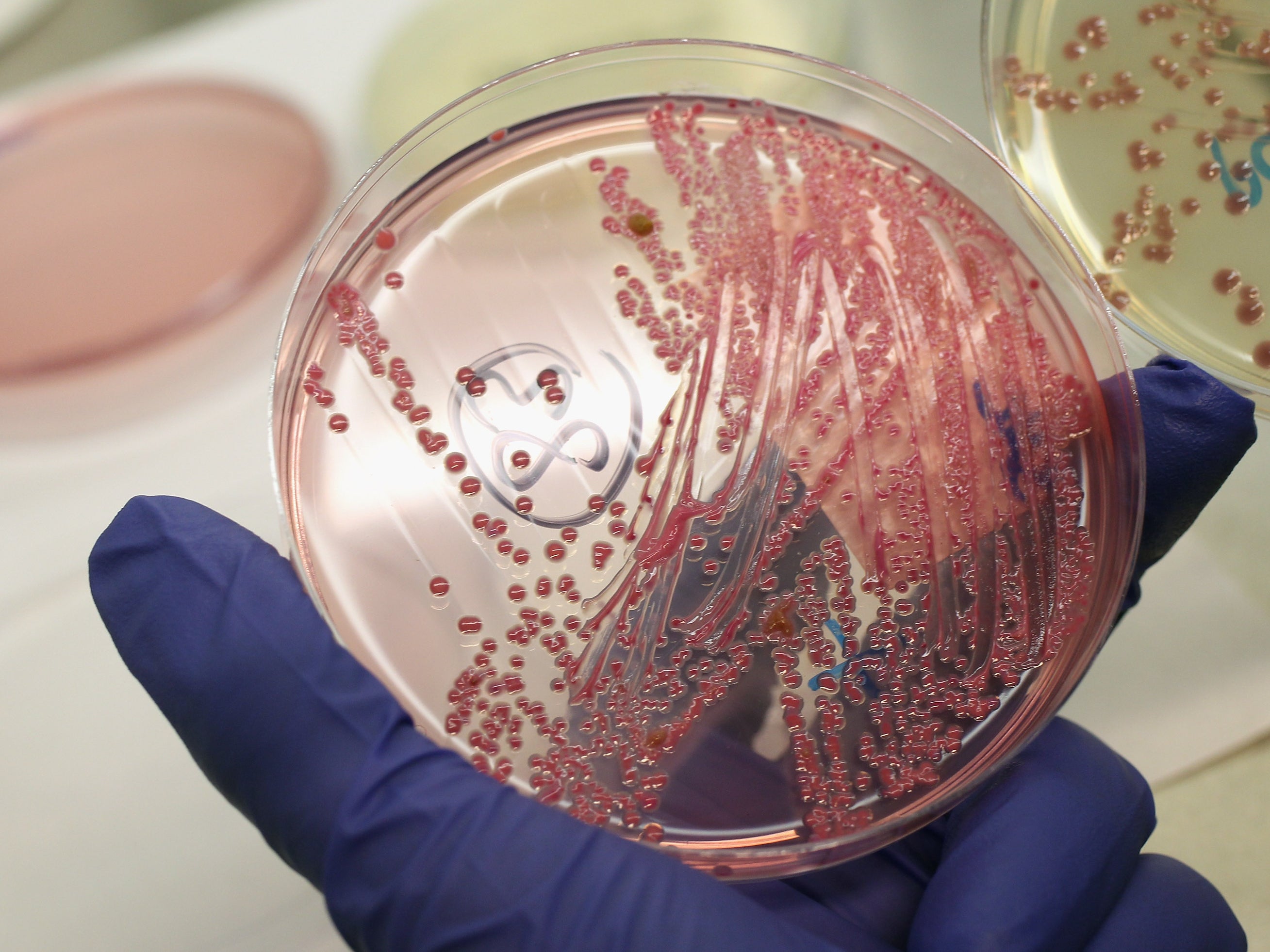 A bacteria culture that shows a positive infection of enterohemorrhagic E. coli