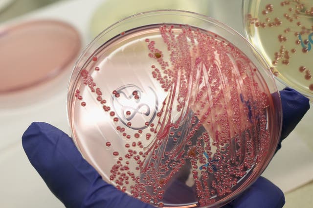 <p>A lab technician holds a bacteria culture that shows a positive infection of enterohemorrhagic E. coli, also known as the EHEC bacteria, from a patient at the University Medical Center Hamburg-Eppendorf on June 2, 2011 in Hamburg, Germany. </p>