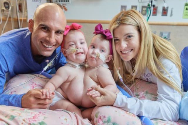 <p>Dom and Maggie Altobelli with their twin daughters Addison and Lilianna. The couples’ daughters were conjoined, but were separated during a surgery at the Children’s Hospital of Philadelphia.</p>