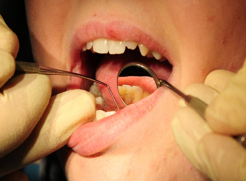 Dentists saw three million fewer patients in 2021 than they did in 2019, figures have shown (Rui Viera/PA)