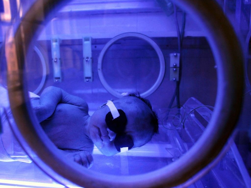 A baby suffering from jaundice lies in a phototherapy unit at Xining Children Hospital in Xining of Qinghai Province, China. Experts have warned of a population crisis in the country due to the lowest birth rates in six decades
