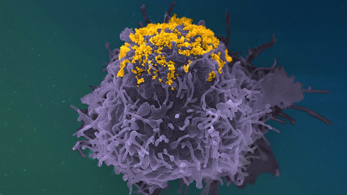 <p>HIV particles (in yellow) accumulating on the surface of an infected cell (in purple)</p>