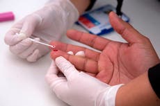 HIV VB: ‘Exceptionally’ virulent variant discovered in the Netherlands