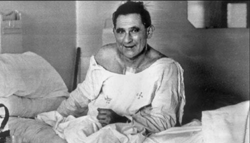 Louis Washkansky received the first ever heart transplant in 1967, though he died 18 days later of pneumonia due to a weakened immune system