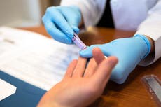 More straight than gay people are being diagnosed with HIV for first time in a decade