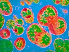 New cases of antibiotic-resistant gonorrhoea identified in England