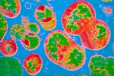 New cases of antibiotic-resistant gonorrhoea identified in England