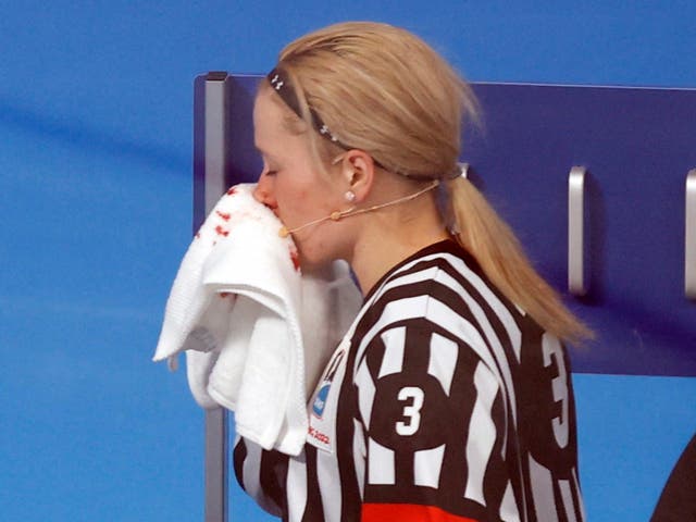 <p>Referee Cianna Lieffers pouring with blood after a stick to the face </p>
