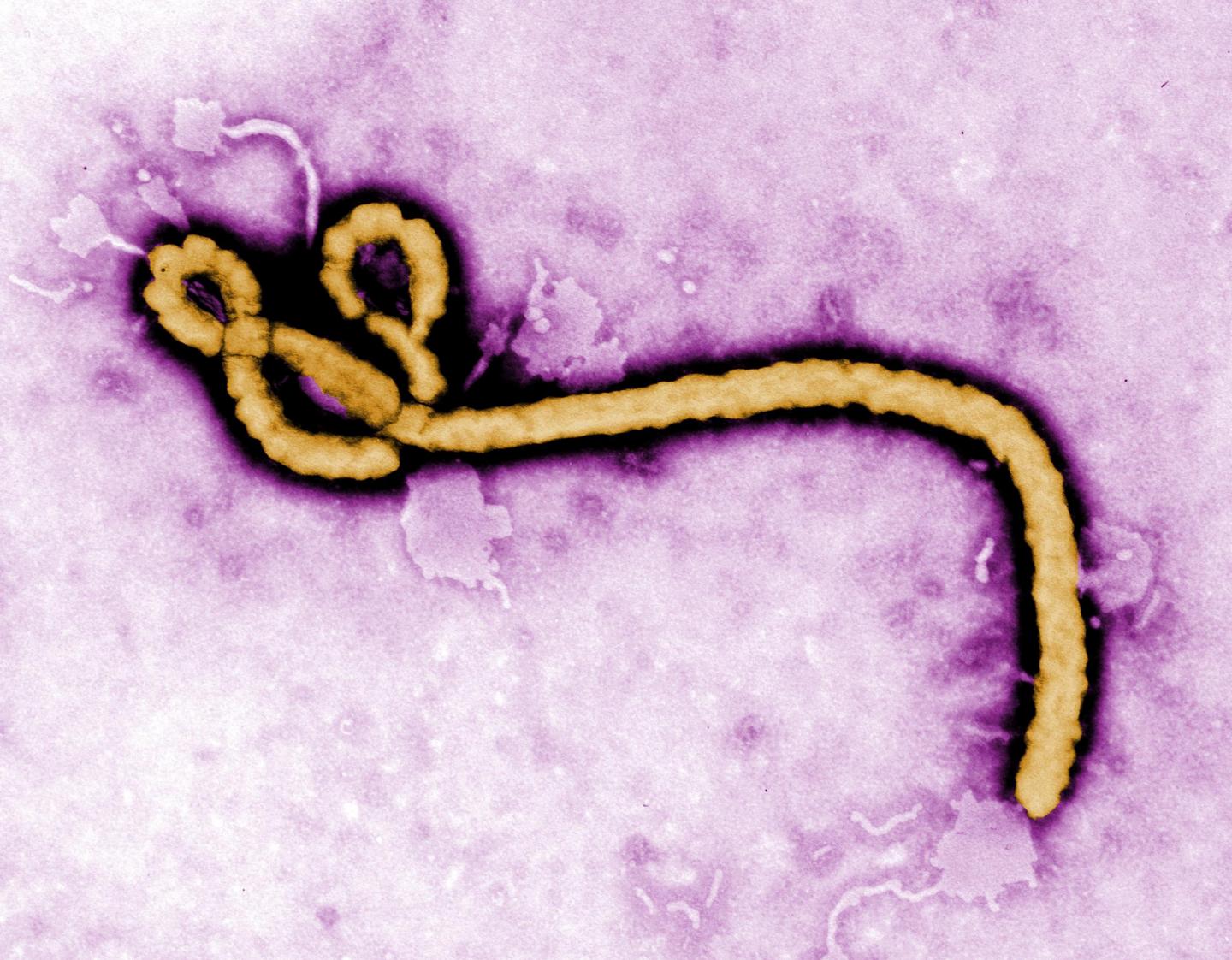 Created by CDC microbiologist Frederick A Murphy, this colourised transmission electron micrograph (TEM) reveals some of the ultrastructural morphology displayed by an Ebola virus virion