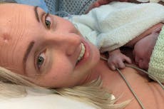 Mother delayed life-saving operation with skin cancer growing on face so she could give birth to son safely