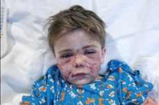 ‘The dog used me as a chew toy, Mummy’: Seven-year-old from Texas left needing surgery after dog attack