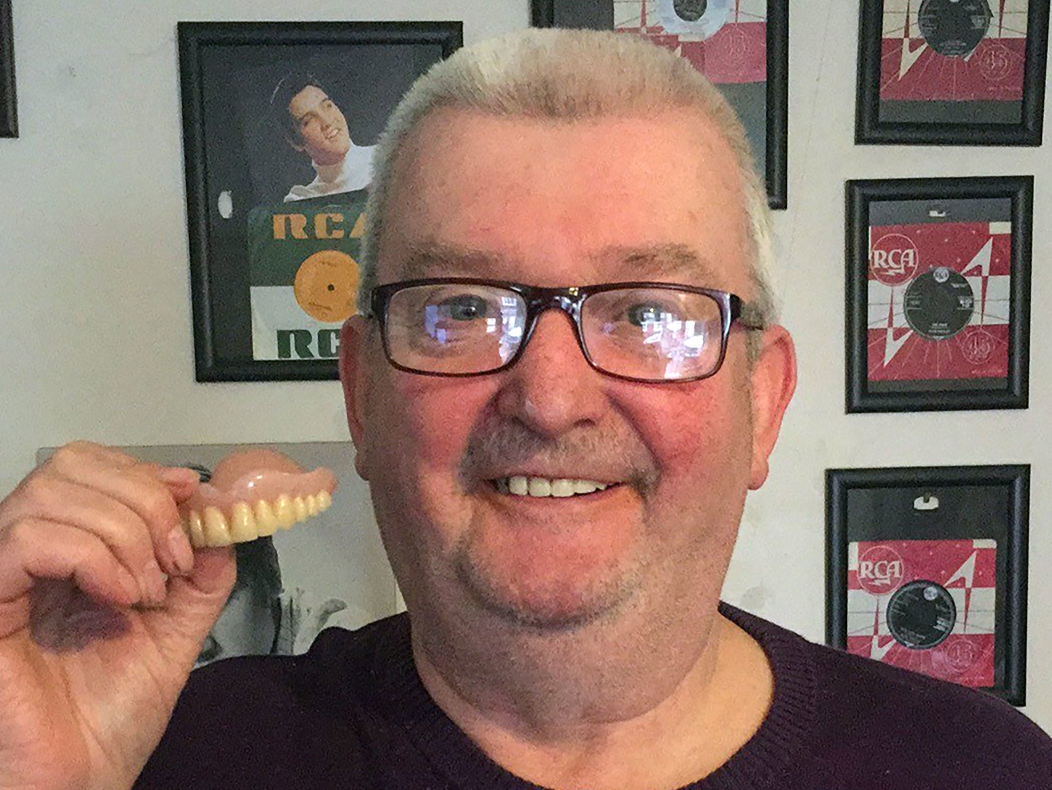Paul Bishop had his false teeth returned 11 years after he lost them overseas
