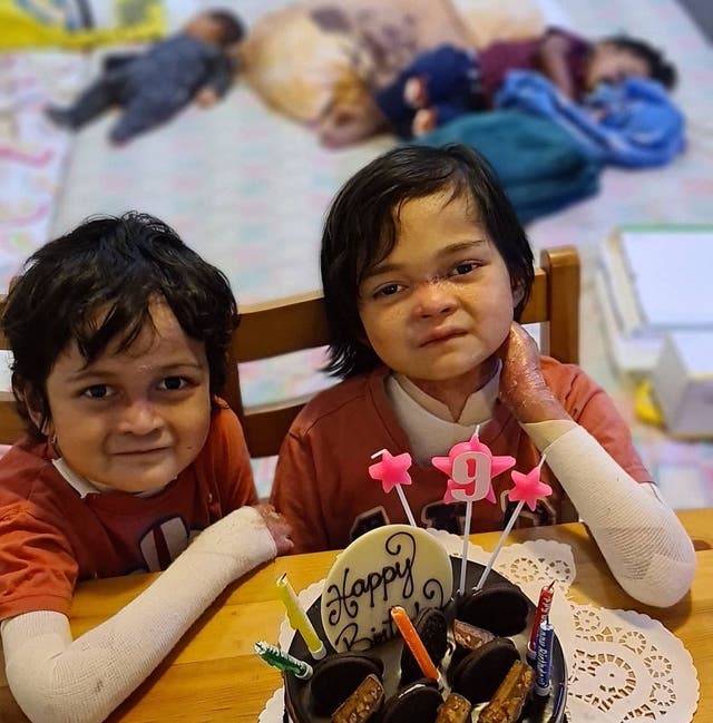 <p>Muhammad Azraqee, 8, and Nur Siddiqah, 10, both suffer from a rare skin disorder that leaves their fingers fused together.</p>
