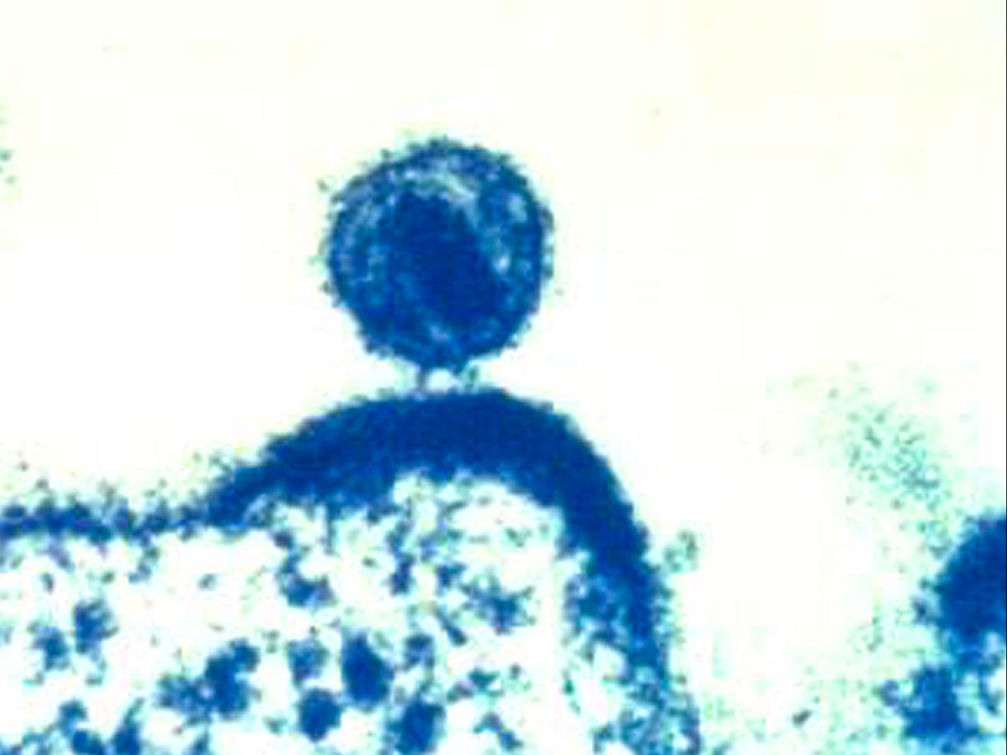 <p>This 2012 colorized electron microscope image made available by the National Institute of Allergy and Infectious Diseases shows a single human immunodeficiency virus</p>