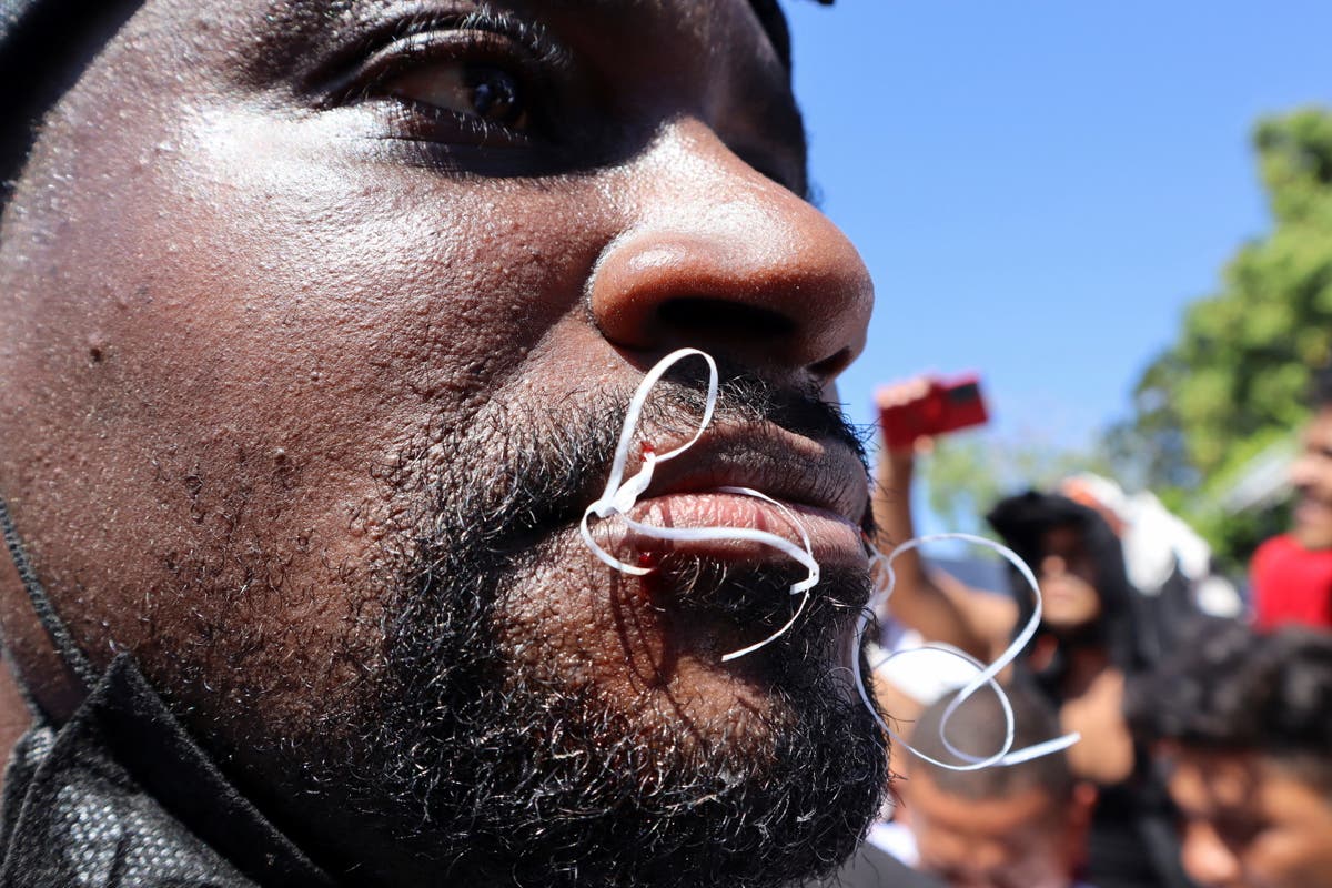 Migrants sew their mouths shut en route to US border to raise alarm on immigration policies