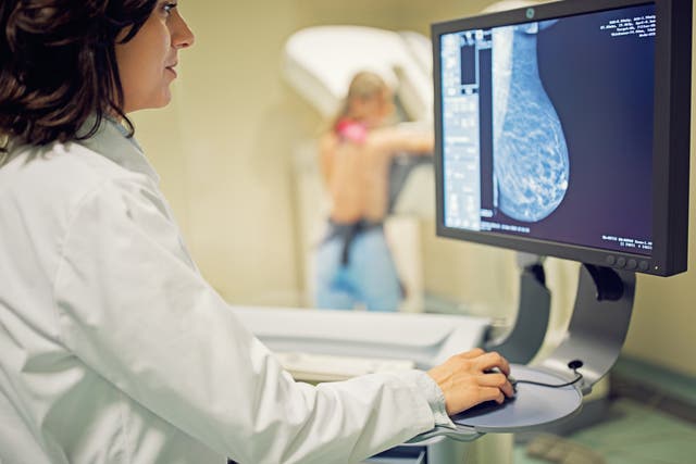 En el Reino Unido, las mamografías se ofrecen a mujeres a partir de los 50 años.