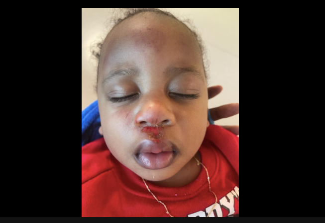 One year old child allegedly injured while in police custody.
