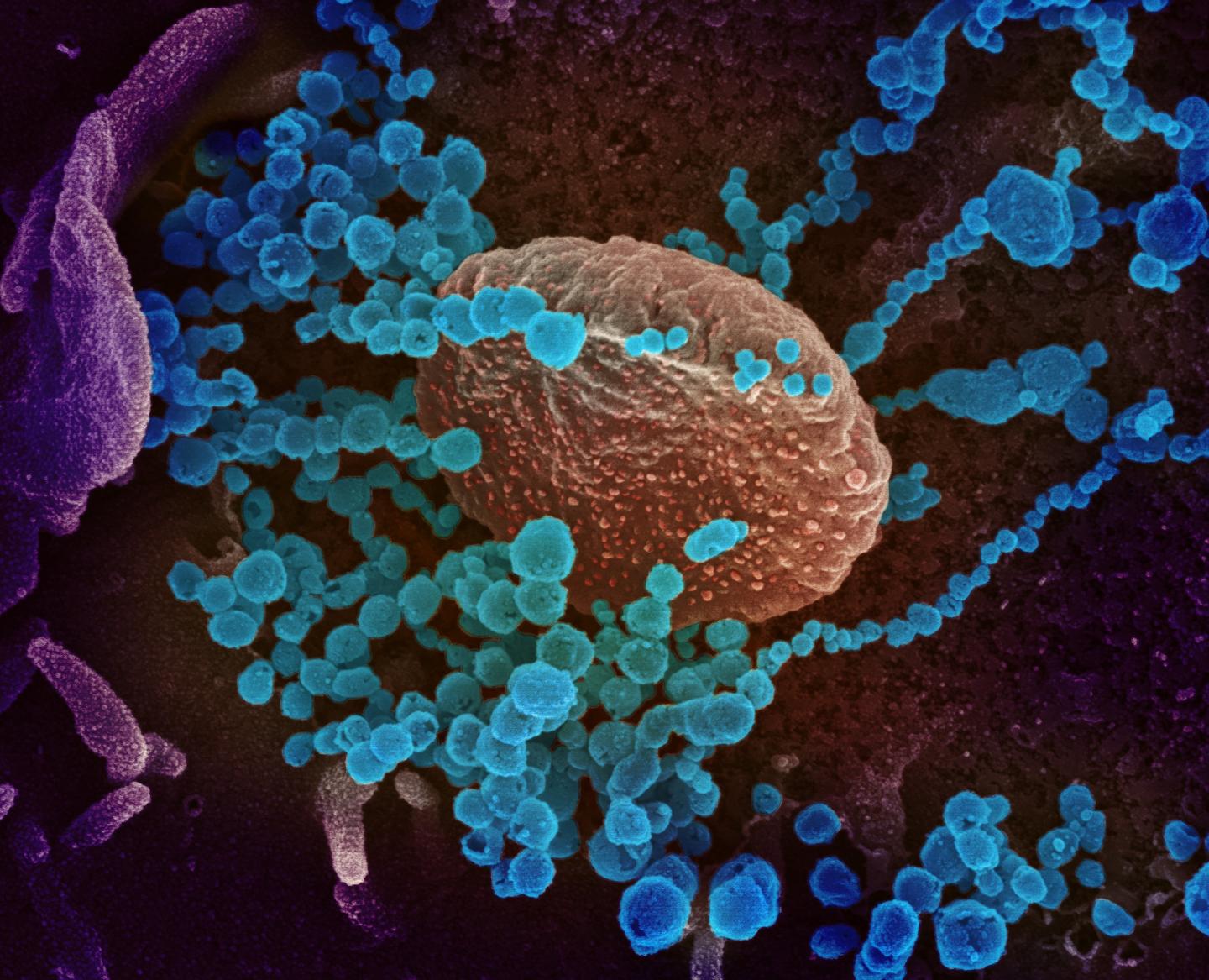 Scanning electron microscope image shows SARS-CoV-2 (round blue objects), the virus that causes COVID-19, emerging from the surface of cells cultured in the lab