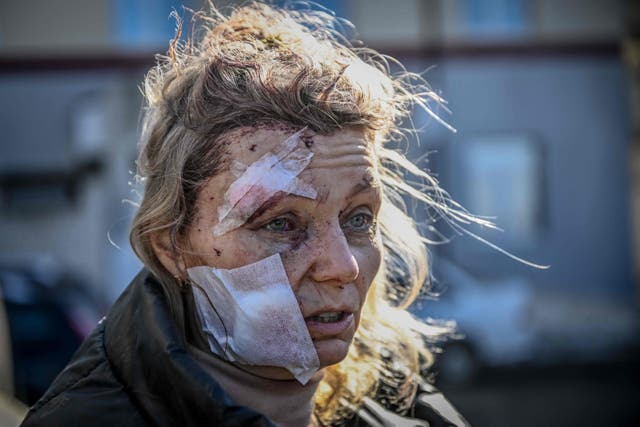 <p>Una mujer herida afuera de un hospital después del bombardeo de la ciudad ucraniana de Chuguiv </p>