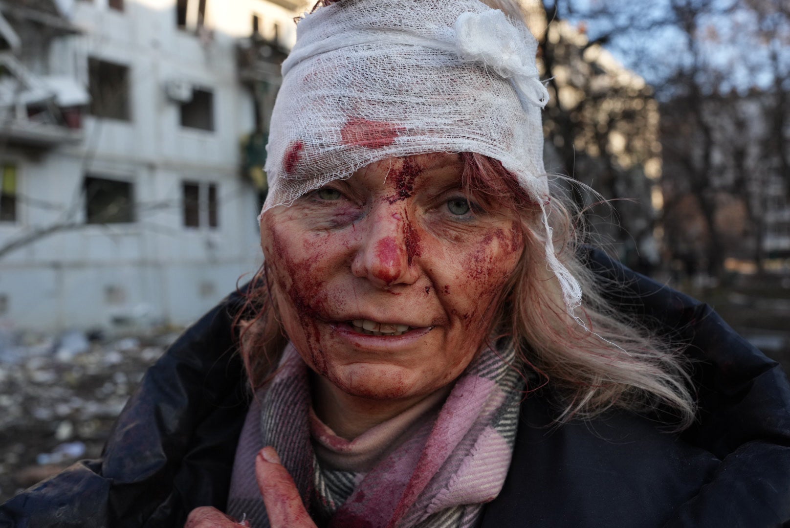 <p>Olena Kurilo, heavily bandaged over her face and head, after a missile struck her home </p>