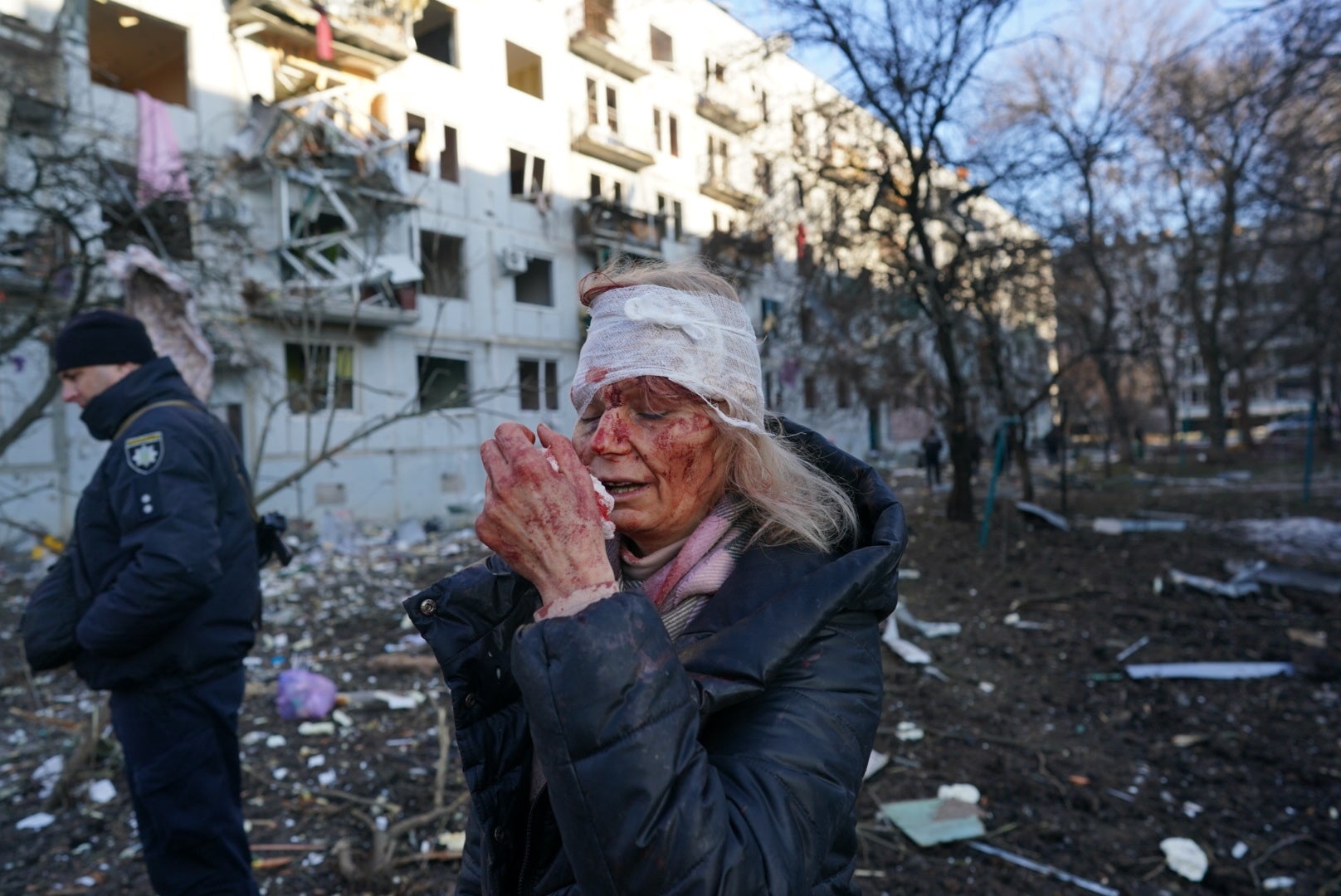A wounded woman is seen after an airstrike damaged an apartment complex in Chuhuiv, Kharkiv