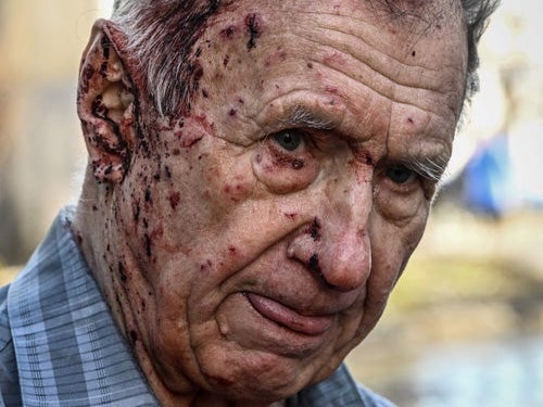 An injured man stands by a vehicle of an emergency unit to receive medical assistance after bombings on the eastern Ukraine town of Chuguiv