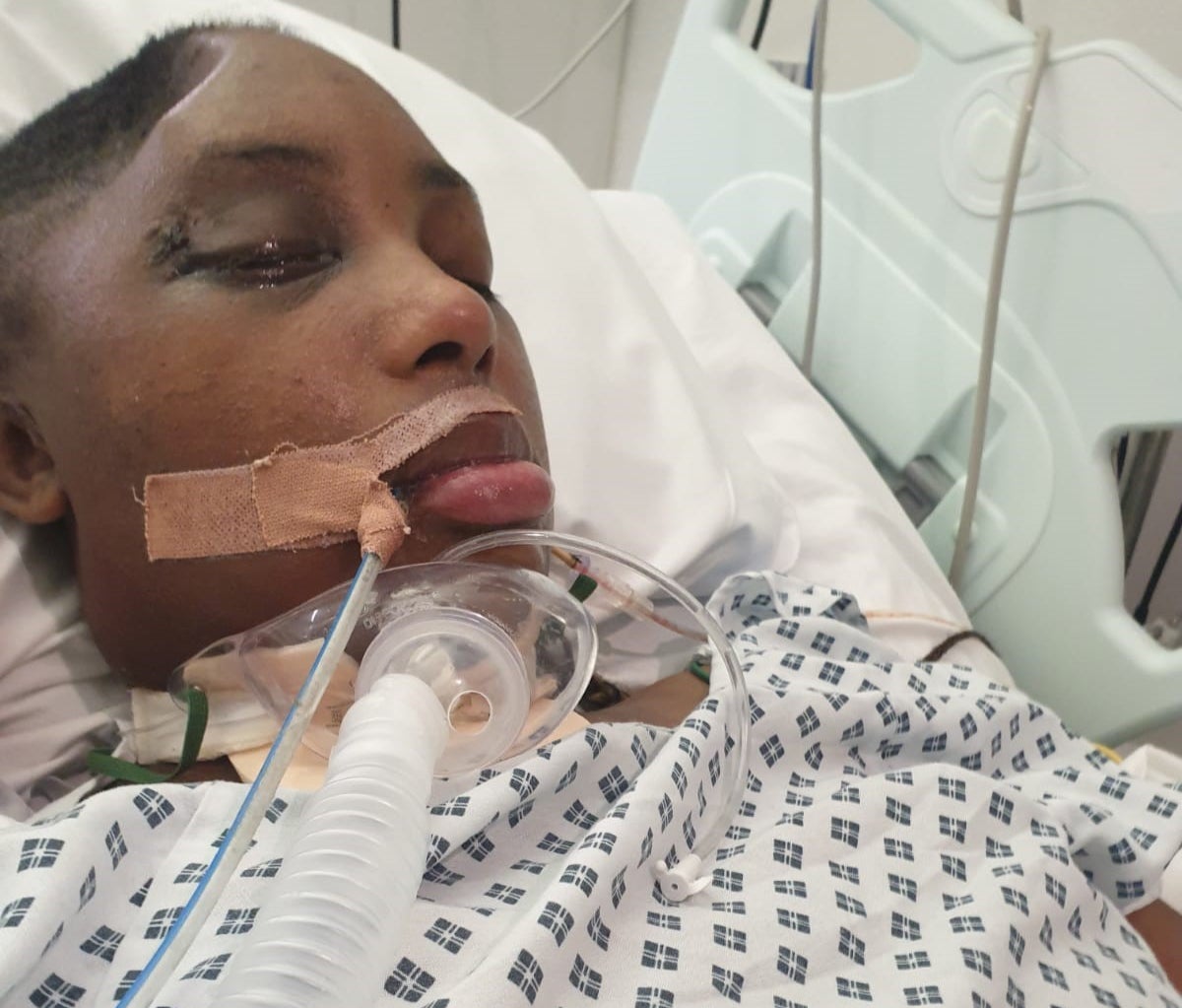 Sasha Johnson remains in hospital more than nine months after the attack with permanent injuries.