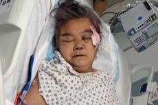 Grandmother dies two months after being struck in the head with a rock in random NYC attack