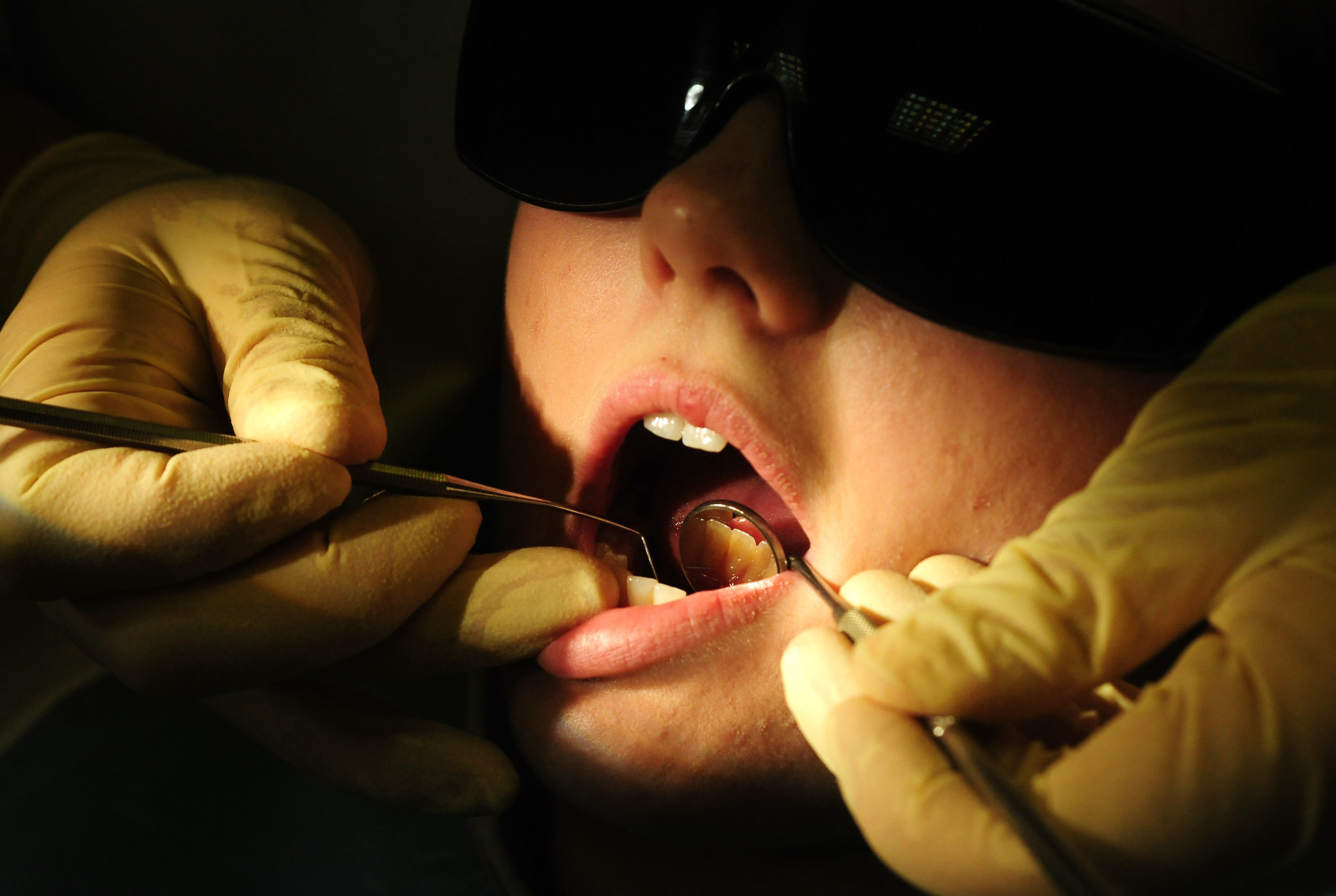 Revised payment arrangements for NHS dentists have been announced (Rui Vieira/PA)