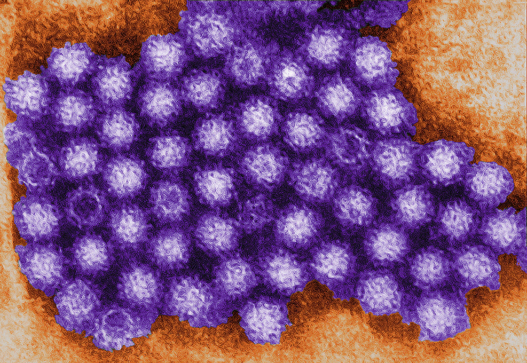 Norovirus seen under a microscope