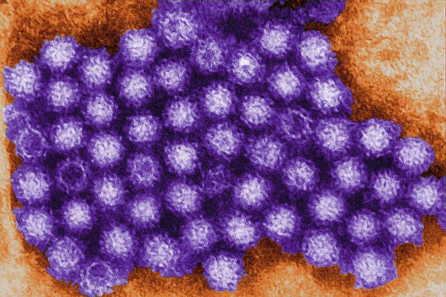 <p>Norovirus seen under a microscope </p>
