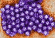 What is norovirus, how does it spread and how long is the incubation period?