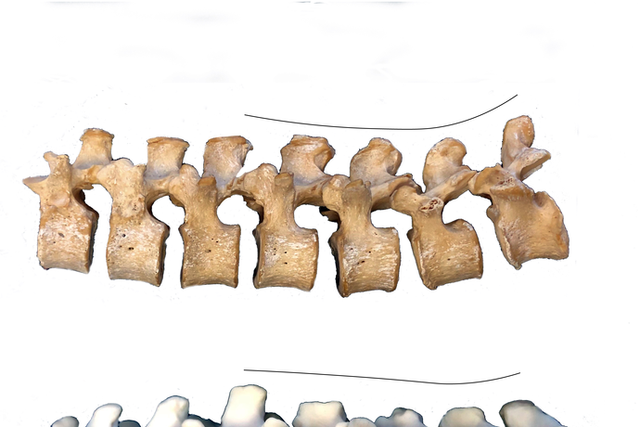 <p>Lower back bones of a Neandertal (Kebara 2 specimen; bottom) and a post-industrial modern human (top) demonstrating differences in wedging and curvature of the lower back</p>