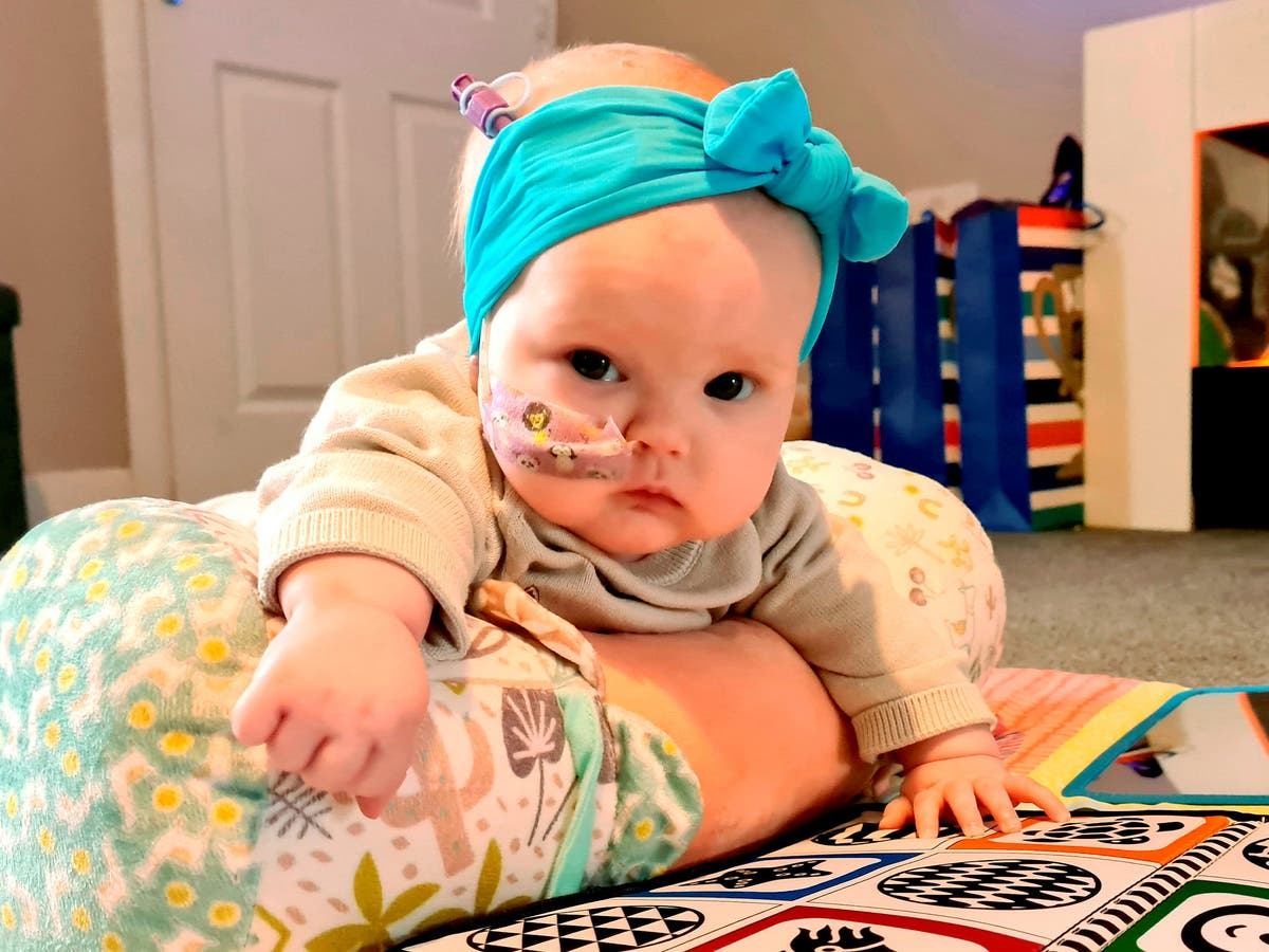 Baby with brain tumour ‘hours from death’ after doctors dismissed swollen head as ‘normal baby stuff’